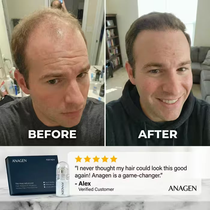 The Most Advanced Hair Regrowth Protocol - FolliGen-X® Formula Micro Infusion System